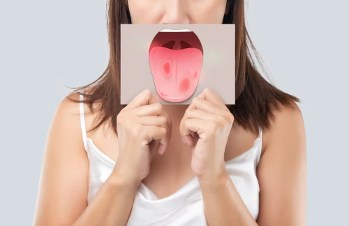 Cómo Detectar Y Prevenir El Vaper's Tongue